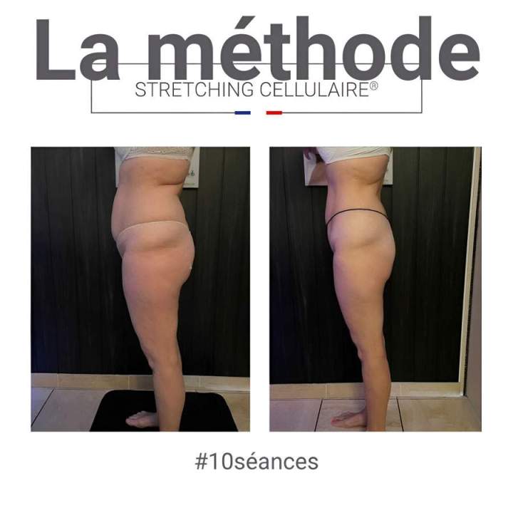 Stretching cellulaire Beauvais