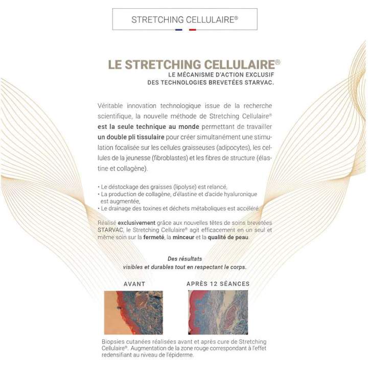 Stretching cellulaire corps Beauvais